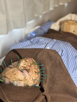 ネオオアシス トウキョウ(ネオOASIS TOKYO)の写真/【業界唯一】美容鍼×ハーブピーリング(剥離なし)で即日ハリツヤのある肌へ