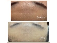 ヒラキヒミ。/毛穴エステ+90分ボディ