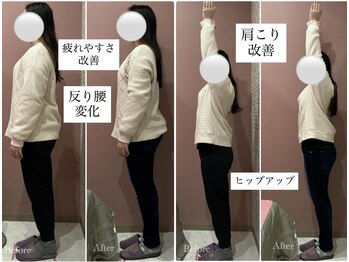 ユルル 刈谷店(Yururu)/変化(骨盤整体＆猫背整体)