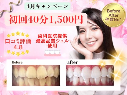 ホワイトニングショップ 福岡春日店の写真