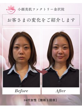 小顔美肌ファクトリー 金沢院の写真/素肌から変わる印象美◇理学療法士監修の肌質改善フェイシャル×小顔ケア