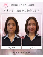 小顔美肌ファクトリー 金沢院