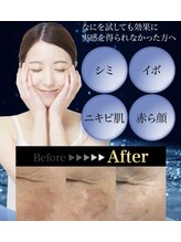 スリーピングビューティー(Sleeping Beauty)/たるみ、くすみ改善