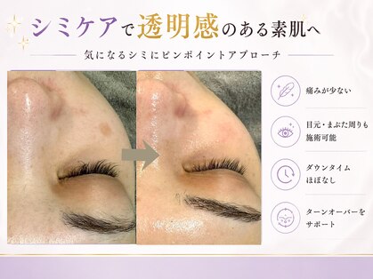 ラテ(Latte)の写真