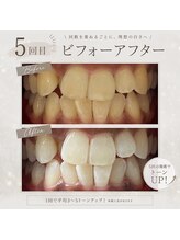 ホワイト 上乃木南店(WHITE)/5回目ビフォーアフター