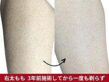 美容脱毛専門サロン エピラージュ 新宿店(Epilage)の雰囲気（女性は女性スタッフが施術。隅々まで丁寧に照射致します。）