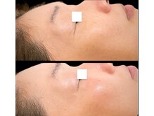 ジーニー(Genie)/ララピール始めました！