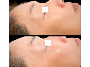 ジーニー(Genie)/ララピール始めました！