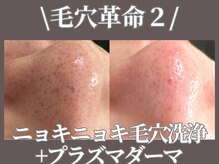 マヴィ 守口店(MavY.)/きゅっとクリーンなお肌へ！