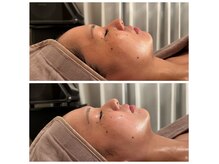 エヌア(nA)の雰囲気（エステはマッサージ付♪首肩こり,デコルテリンパ,小顔,むくみ◎）