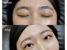 エニング(ening)/Before→After