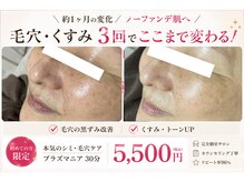 ミュベル(Myubelle)