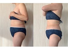 キアラ(Chiara)/痩身マシーン☆上半身コース