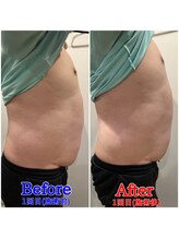 ファビー(Fabby)/マグフォース1回のビフォアフ