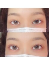 サンパ(SYMPA)/メーテルロット