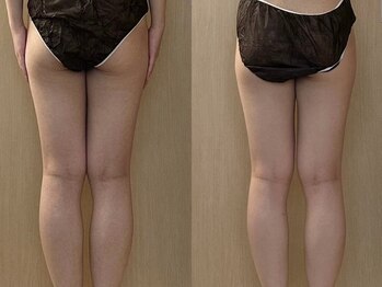 マイティー整骨院 ココア(CoCoa)/活性リンパ洗浄