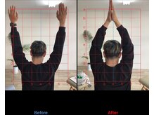 ストレチックス 近江八幡店/BeforeAfter