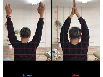 ストレチックス 近江八幡店/BeforeAfter