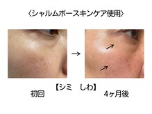 サロン ド クラール(salon de curar)の雰囲気（【40代後半、3ヶ月後の変化】肌育フェイシャル初回クーポンあり）