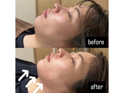 サルース(Salus)の写真