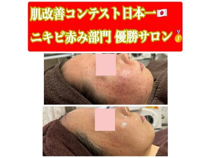 ビエル(Bielle)の写真