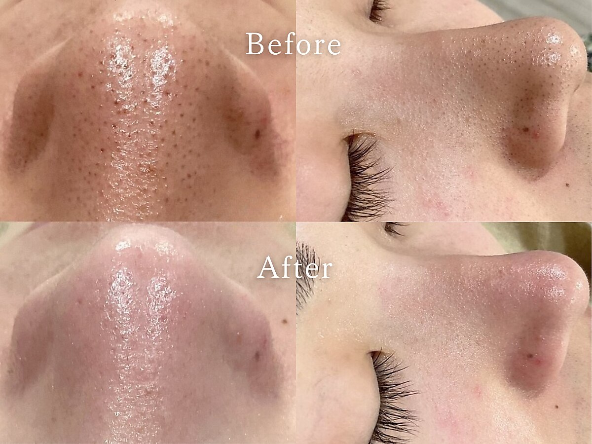 ファッショニスタ 恵比寿東口(Fashionista)｜ホットペッパービューティー