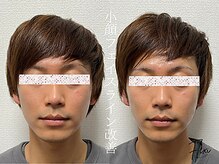 フレキシ 表参道(Flexi)/小顔矯正＋整体