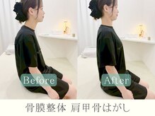 ヒラメント 藤沢(Hilament)/肩甲骨はがしのビフォーアフター