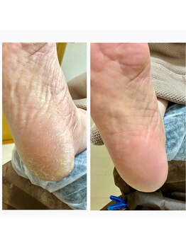 ネイル キシミー(Nail-Kishimi)/