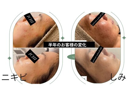 イチ(ICHI)の写真