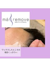 アストル/マリムーブフェイシャルワックス