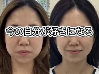 サクラ 伊勢原店(SAKURA)/フェイシャルエステ以上の効果