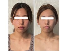 アンジェリオーラ(angeli aura)の雰囲気（【小顔矯正】たるみやシワのお悩みの方も筋膜リリースで改善！）