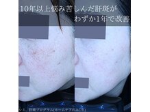 アウラプラス(Aura+)の雰囲気（その場限りではなく”根本改善”を目指しています）