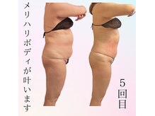 ナナイロ(nanairo)