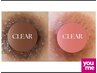 【福岡初】１回で実感！黒ずみケア《CLEAR》VIO・唇など。カウンセリング0円