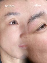 ミーククル(MEKUKURU)/眉毛-ハリウッドブロウリフト