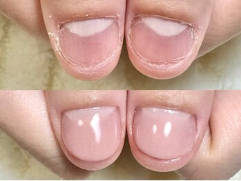 グラシナ なんば店/深爪/自爪育成/フィルイン