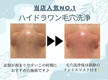 クリアボックス(Clear box)