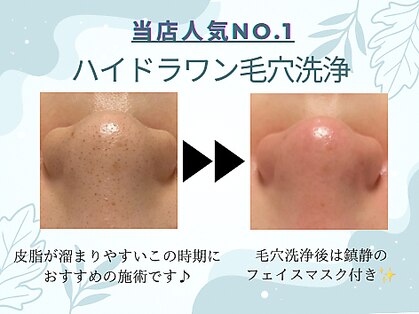 クリアボックス(Clear box)の写真