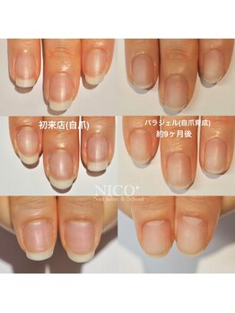 ニコプラス(NICO+)/