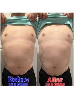 ファビー(Fabby)/マグフォース1回のビフォアフ