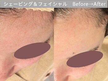 ももとゆでたまご/顔剃り　ビフォーアフター