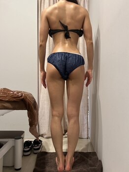 ビセラ(Vicella)の写真/【満足度抜群！最新フォースカッター導入★】マシン＋リンパドレナージュで代謝UPしながら理想のボディに！