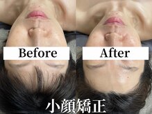 アンバー(amber)の雰囲気（結果にこだわった小顔矯正は浮腫もスッキリ！頭痛改善の声も◎）
