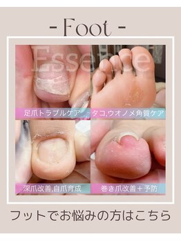 エッセンス (Essence)/Footのお悩みもご相談ください◎