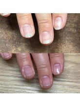 リリ(lili)/トータルハンドケア/ネイルケア