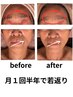 【シワ、タルミ改善】最強エイジングフェイシャル！