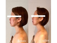 アトリエドゥアージュ(Atelier de age)/エイジングケア横