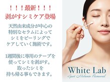 アルッカ(Arukka)の雰囲気（【！最新！】剥がすシミケア★）